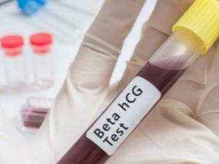 Задержка 10 дней, тест отрицательный: может ли быть беременность, возможны ли другие причины?