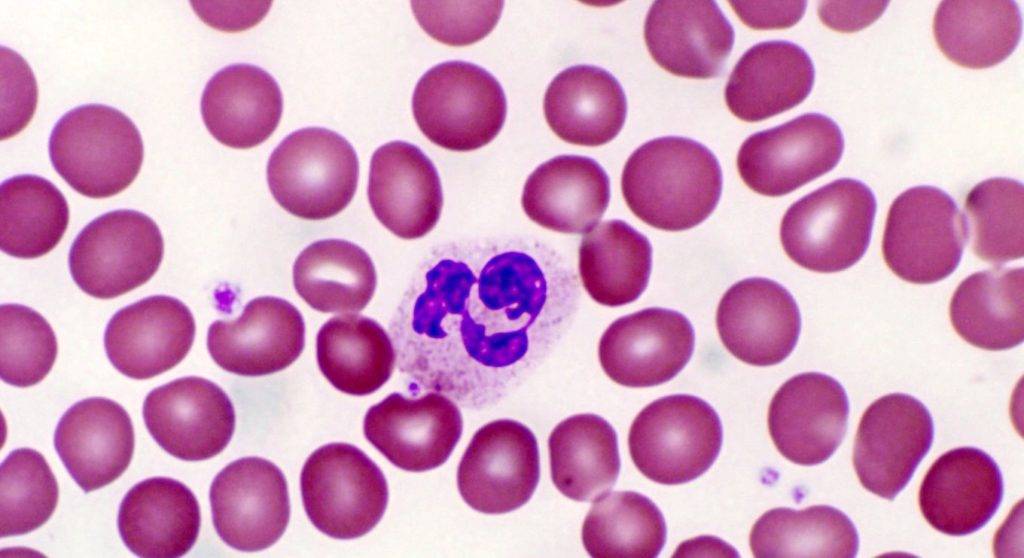 У ребенка повышены базофилы: причины и нормы анализа крови