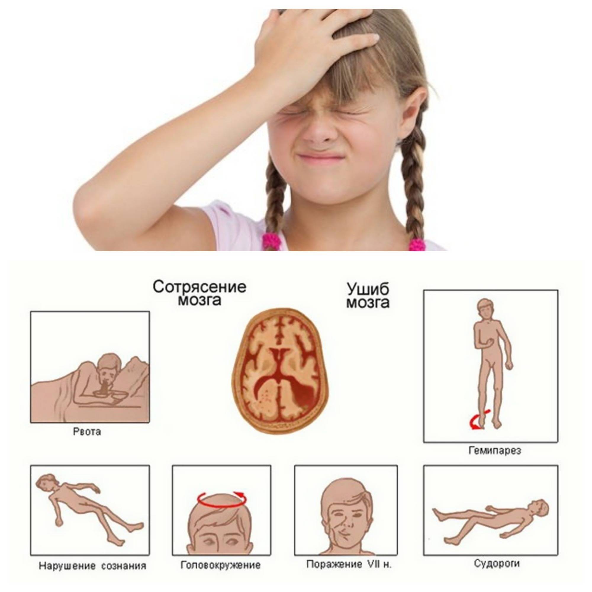 Почему ребенок стал моргать глазами и часто щуриться: причины и лечение