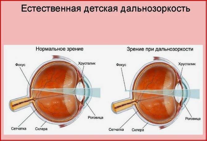 Гимнастика для глаз для детей в детском саду и дома: видео-упражнения для зрения