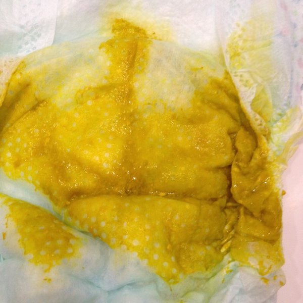 Как и сколько новорожденный должен какать, или все о стуле грудничков