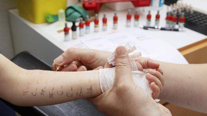 Симптомы аллергии на собак, особенности лечения грудничков и детей старшего возраста