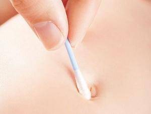 Кровит пупок у новорожденного: что делать, почему кровоточит на 2-3 неделе?