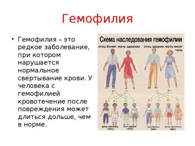 Гемофилия - лечение, причины, признаки гемофилии