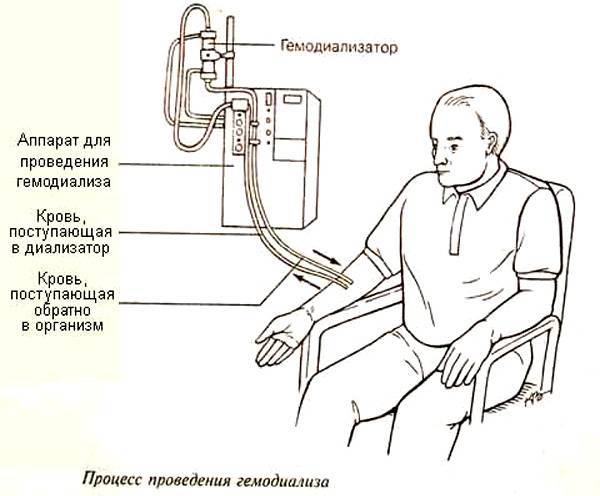 Гипоплазия почки у ребенка: причины, симптомы и лечение