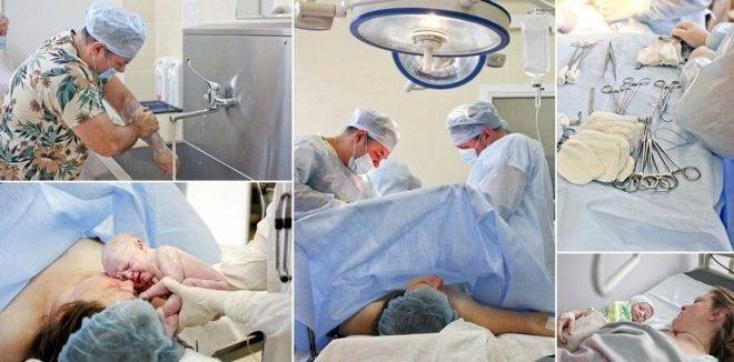 Грудное вскармливание после кесарева сечения: когда приходит молоко?