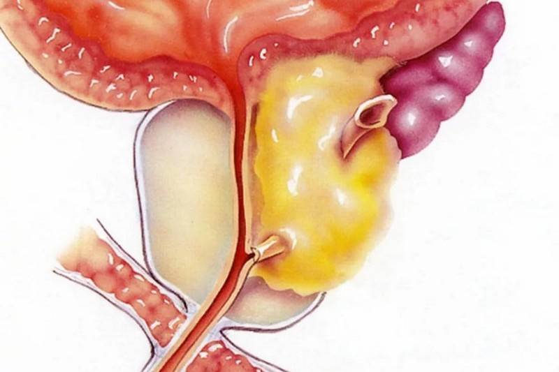 Эритроциты, лецитиновые зерна и клетки эпителия в спермограмме: что это означает?