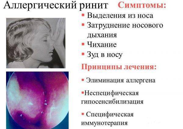 Першение в горле у ребенка: причины постоянного покашливания и лечение