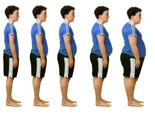 Ожирение у детей разной степени: фото, таблица по возрасту, профилактика и лечение