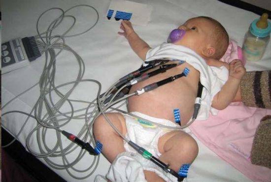 Расшифровка результатов ЭКГ у ребенка: нормы показателей и причины нарушений