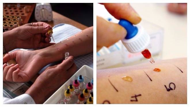 Определить наличие аллергии по анализу крови