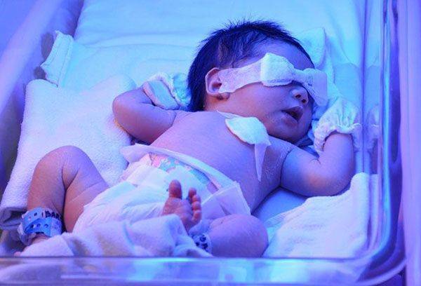 Фототерапия при желтухе у новорожденных: лечение в домашних условиях с помощью лампы