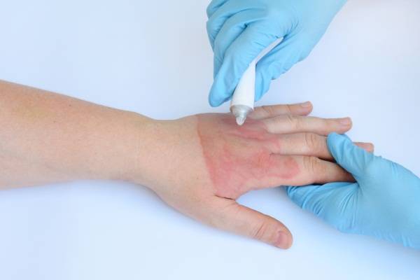 Мазь для заживления ран у детей: средства для обработки ссадин на коже