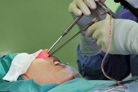 Вазомоторный ринит у детей: симптомы и лечение заболевания, профилактика