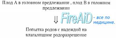 Многоплодная беременность: виды, причины, особенности вынашивания и родов