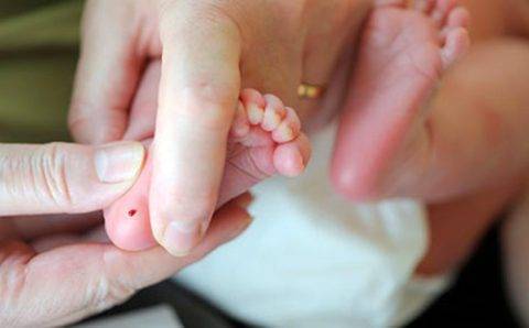 Цветовой показатель крови понижен у ребенка: причины, норма, лечение