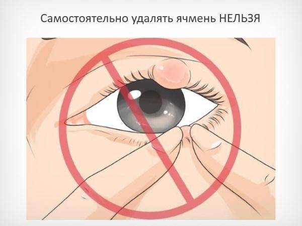 Как лечить ячмень на глазу у ребенка в домашних условиях: быстрые способы терапии чирей