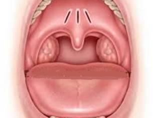 Рыхлое горло у ребенка - что это значит и чем лечить заболевание?