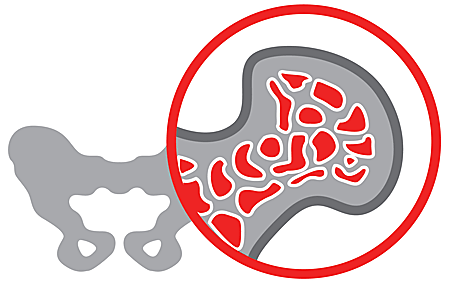 HLA-типирование супругов: что это такое, как происходит расшифровка результатов?