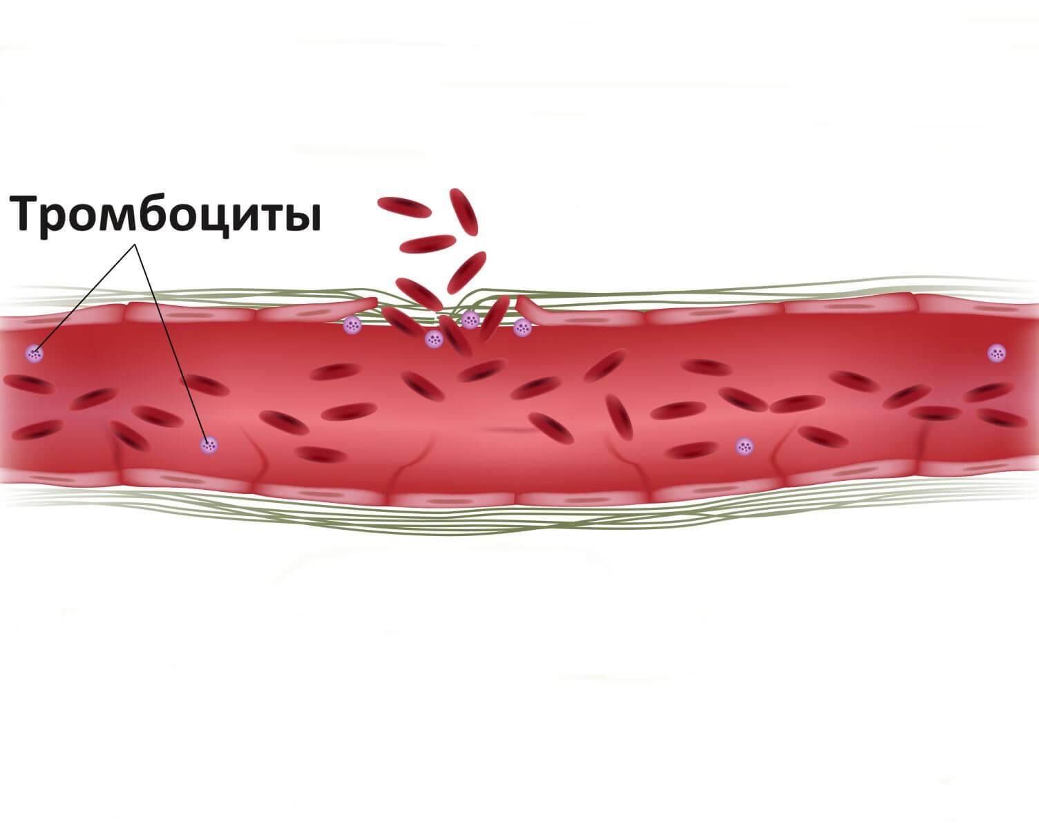Свертываемость крови - норма у детей по времени, расшифровка коагулограммы в таблице