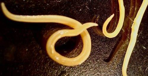 Ребенок толкается внизу живота: почему шевеление плода ощущается в этой области?