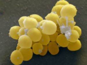 Золотистый стафилококк в горле у ребенка: лечение и симптомы бактерий в мазке из зева