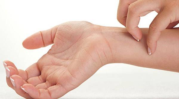 Как уменьшить Манту на руке в домашних условиях - можно ли мазать "Фенистилом" и другими средствами?