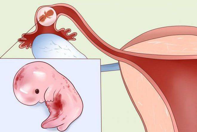 Задержка месячных и белые выделения при отрицательном тесте: причины, боль и другие симптомы