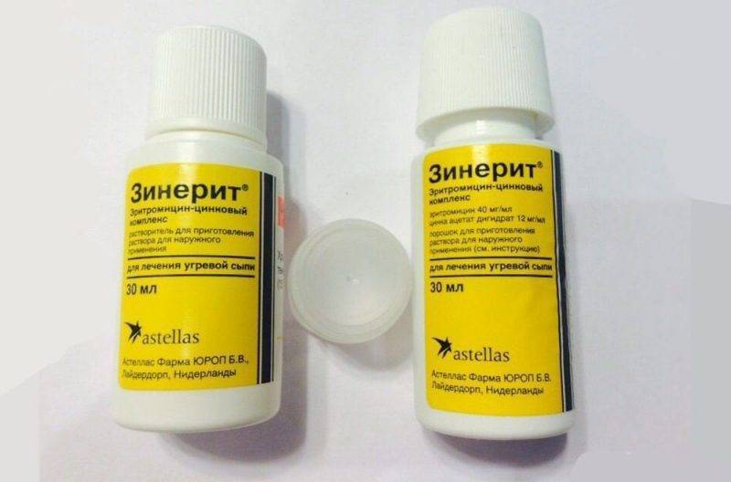 После родов прыщи на лице: почему появляются акне и сыпь и что делать?