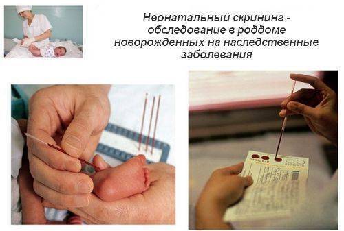 Как развивается галактоземия у детей и как проводится лечение галактоземии у детей: профилактика и питание при галктоземии у детей. основные симптомы галактоземии у детей