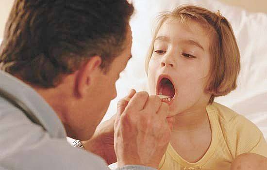 Золотистый стафилококк в горле у ребенка: лечение и симптомы бактерий в мазке из зева