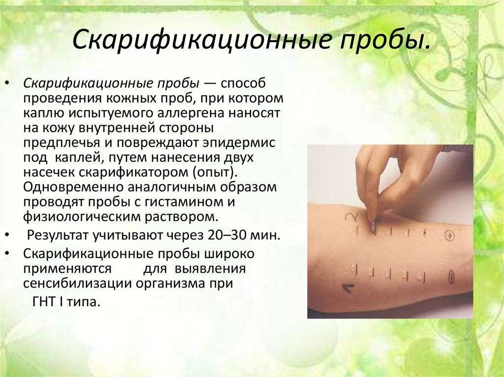 Кровь на аллергены у ребенка