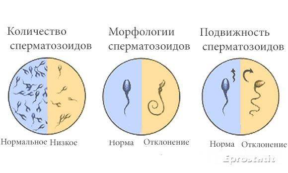 Эритроциты, лецитиновые зерна и клетки эпителия в спермограмме: что это означает?