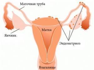 Бежевые выделения при беременности на ранних сроках светлого, желтого или коричневого оттенка