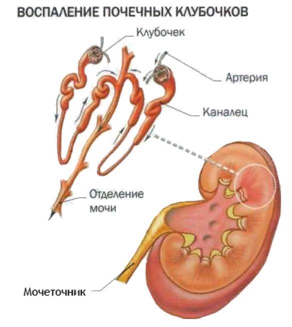 Что означает повышение глюкозы в моче у ребенка: причины и способы коррекции