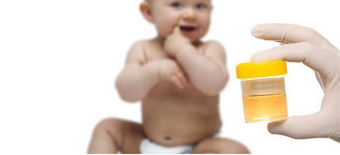 Как собрать мочу у грудничка (девочки, мальчика): мочеприемник для новорожденных