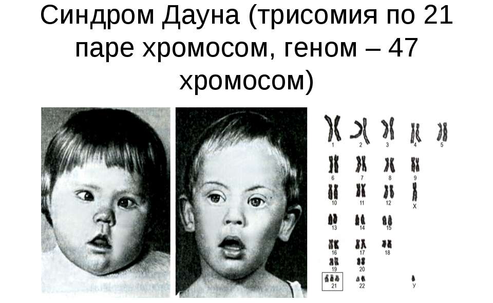 Генетический анализ при беременности: для чего проводится, что определяет, каковы нормы показателей?