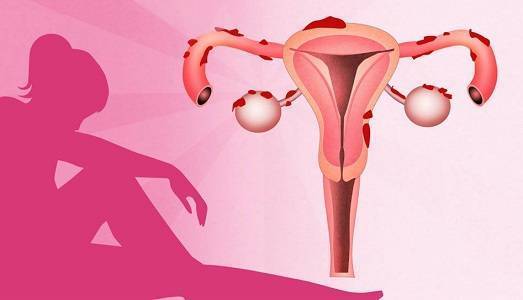 Проблемы после приема Норколута: нет месячных или они слишком обильные, что делать?