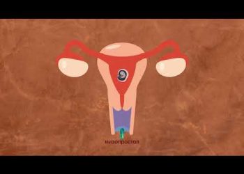 Нежелательная беременность на ранних сроках — причины, последствия и способы предотвращения