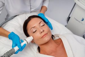 Преимущества фотоомоложения с помощью микроигольчатого лифтинга