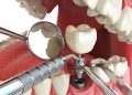 Советы по выбору надежной стоматологии для установки зубов