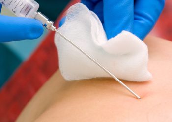 Стернальная пункция: Эссенция Процедуры и Ее Потенциальные Риски