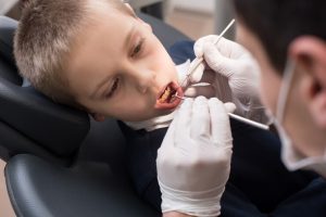 Удаление Молочного Зуба: Когда, Почему и Как