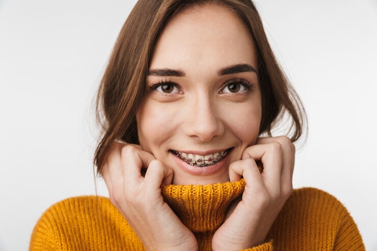 Самолигирующие металлические брекеты: особенности и преимущества