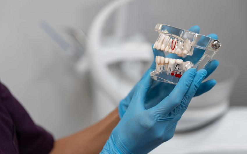 Как продлить срок службы зубных имплантов: советы стоматологов