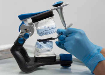 Как продлить срок службы зубных имплантов: советы стоматологов