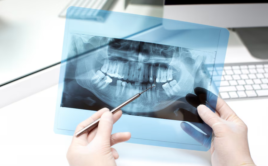 Что из себя представляет все на 6 имплантах