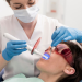 Особенности проведения профессиональной чистки зубов