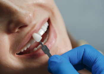 Что из себя представляет безметалловая керамическая коронка