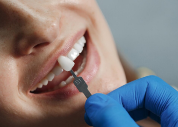 Что такое имплантация зубов?